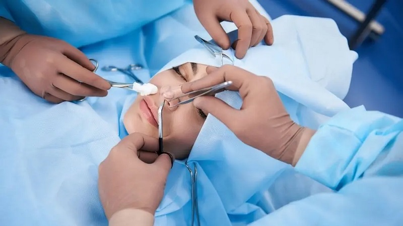 استفاده از سوند هنگام جراحی بینی | جراح بینی اصفهان | دکتر علی علوی راد