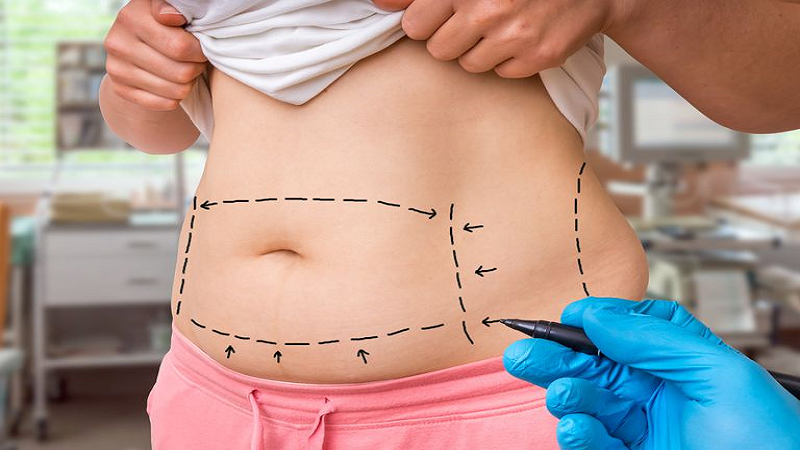تکنیک های انجام پیکرتراشی و عوارض آنها
