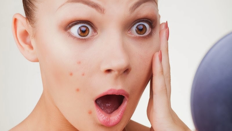 علل جوش زدن صورت بعد از جراحی بینی | جراح پلاستیک اصفهان
