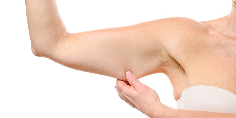 لیپوساکشن بازو یا جراحی براکیوپلاستی