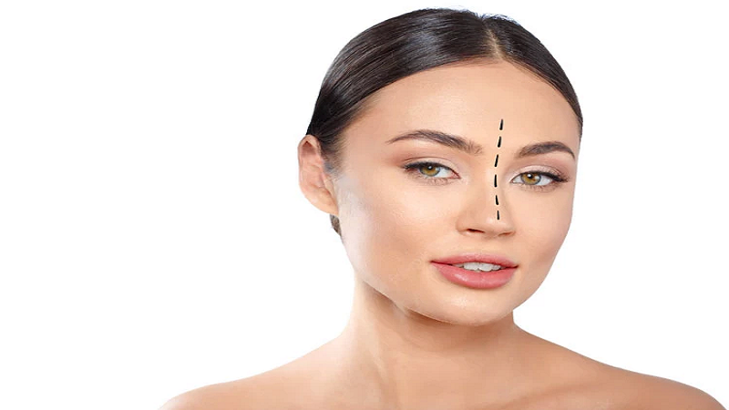 جراح بینی اصفهان | نکاتی درباره عمل بینی گوشتی