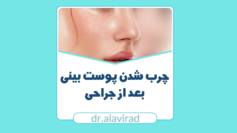 چرب شدن پوست بینی بعد از جراحی | جراح بینی اصفهان | دکتر علی علوی راد