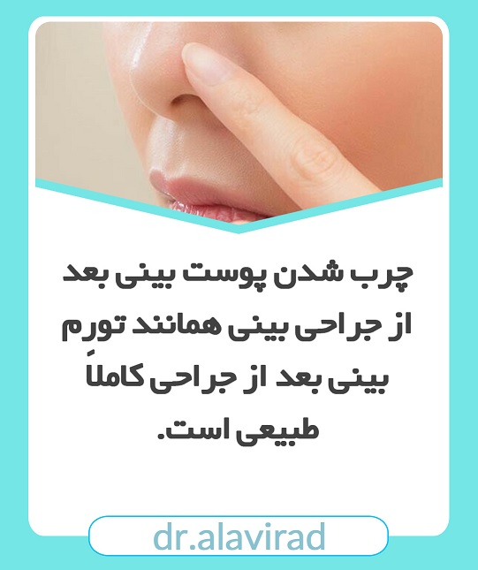 چرب شدن پوست بینی بعد از جراحی | جراح بینی اصفهان | دکتر علی علوی راد