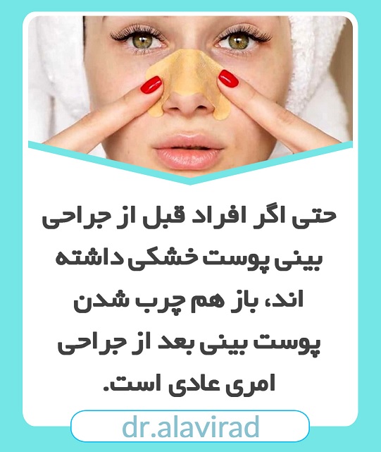 چرب شدن پوست بینی بعد از جراحی | جراح بینی اصفهان | دکتر علی علوی راد