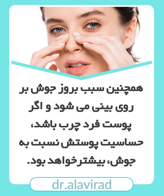 چرب شدن پوست بینی بعد از جراحی | جراح بینی اصفهان | دکتر علی علوی راد