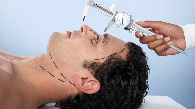همه چیز راجع به جراحی بینی آقایان | جراح بینی اصفهان | دکتر علی علوی راد