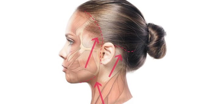 روش های مختلف لیفت صورت