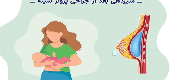 شیردهی و حاملگی بعد از پروتز سینه