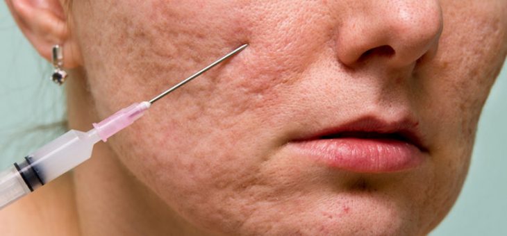 مراقبتهای قبل و بعد از سابسیژن